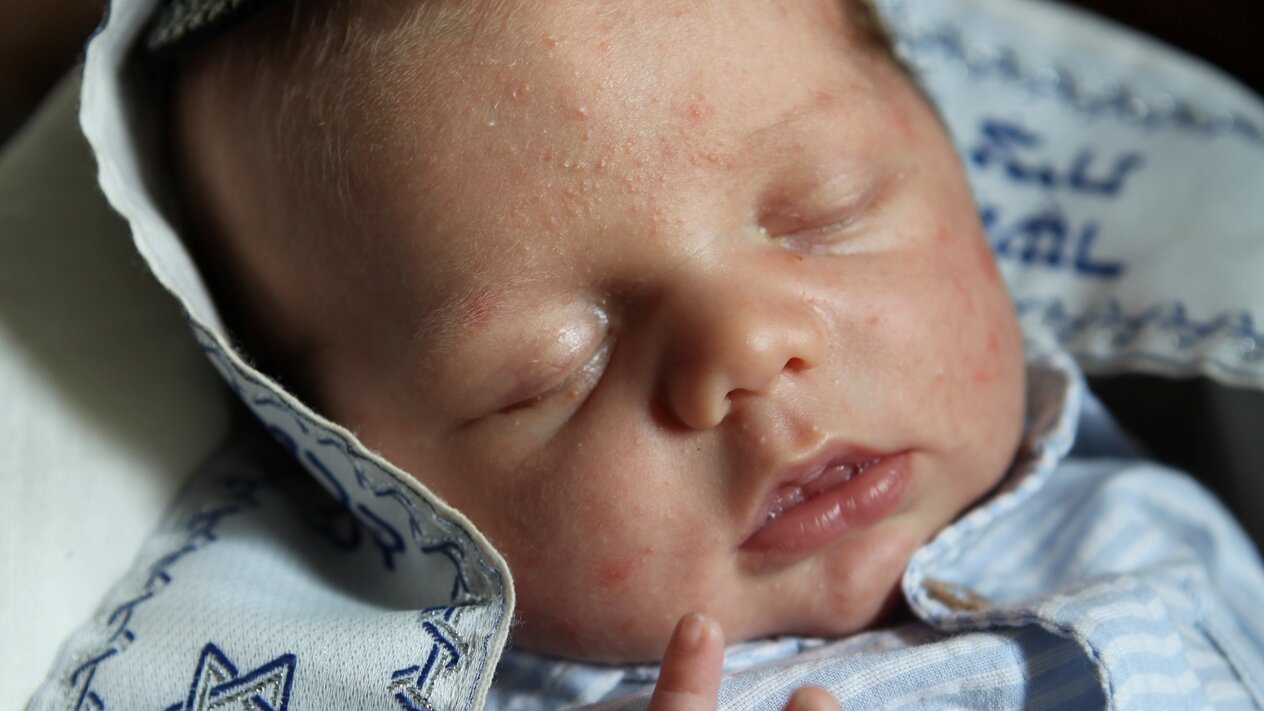 Baby bei einer Brit Mila 